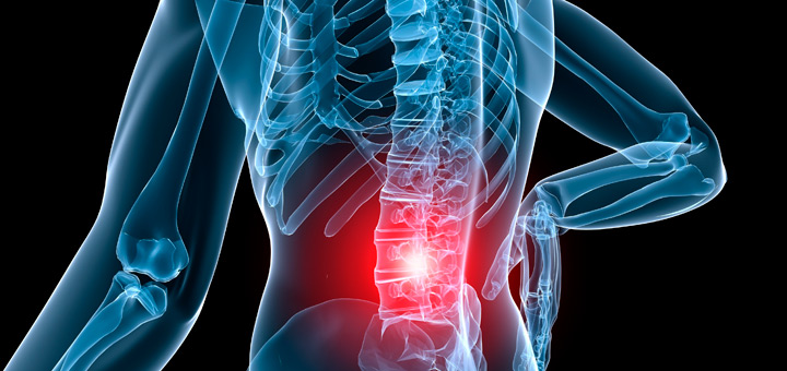 clinica internacional traumatologia hernia discal dolor espalda
