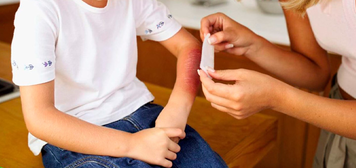 Fuegos artificiales pueden ser peligrosos, especialmente en las manos de  niños, UCI Health