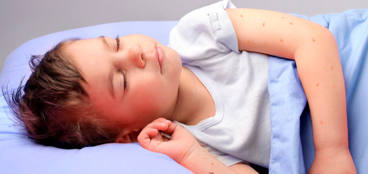 signos reaccion alergica