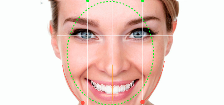 diseno de sonrisa procedimiento beneficios