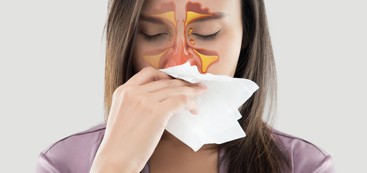 sintomas rinitis alergica