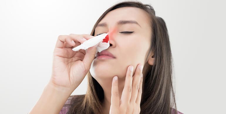 por que sangra nariz motivo preocupacion